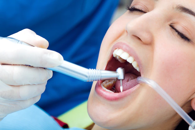Advantages of Implant Dental Treatment