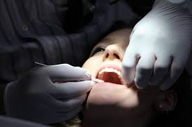 Dental Veneers 
