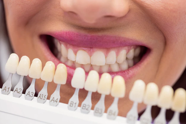Is It Safe to Have a Dental Implant in Bulgaria